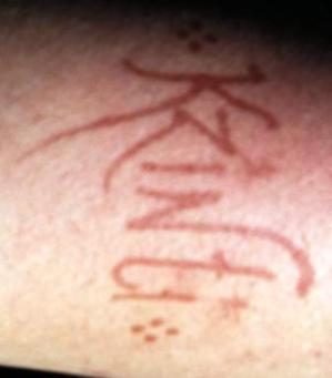 I have a lot of freckles which doesn't help this.